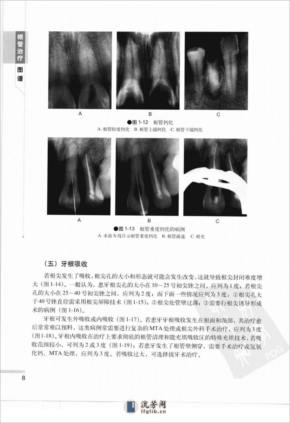 根管治疗图谱 - 第15页预览图