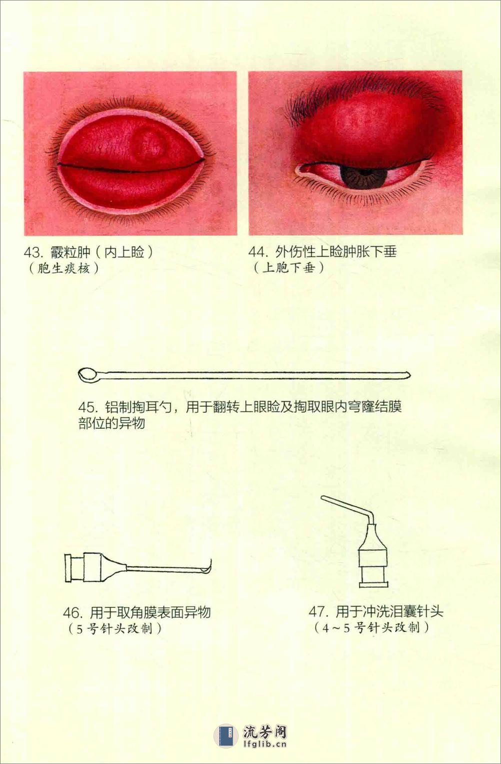 眼病治疗绝招 王霖有 _978-7-5132-4379-7 - 第15页预览图