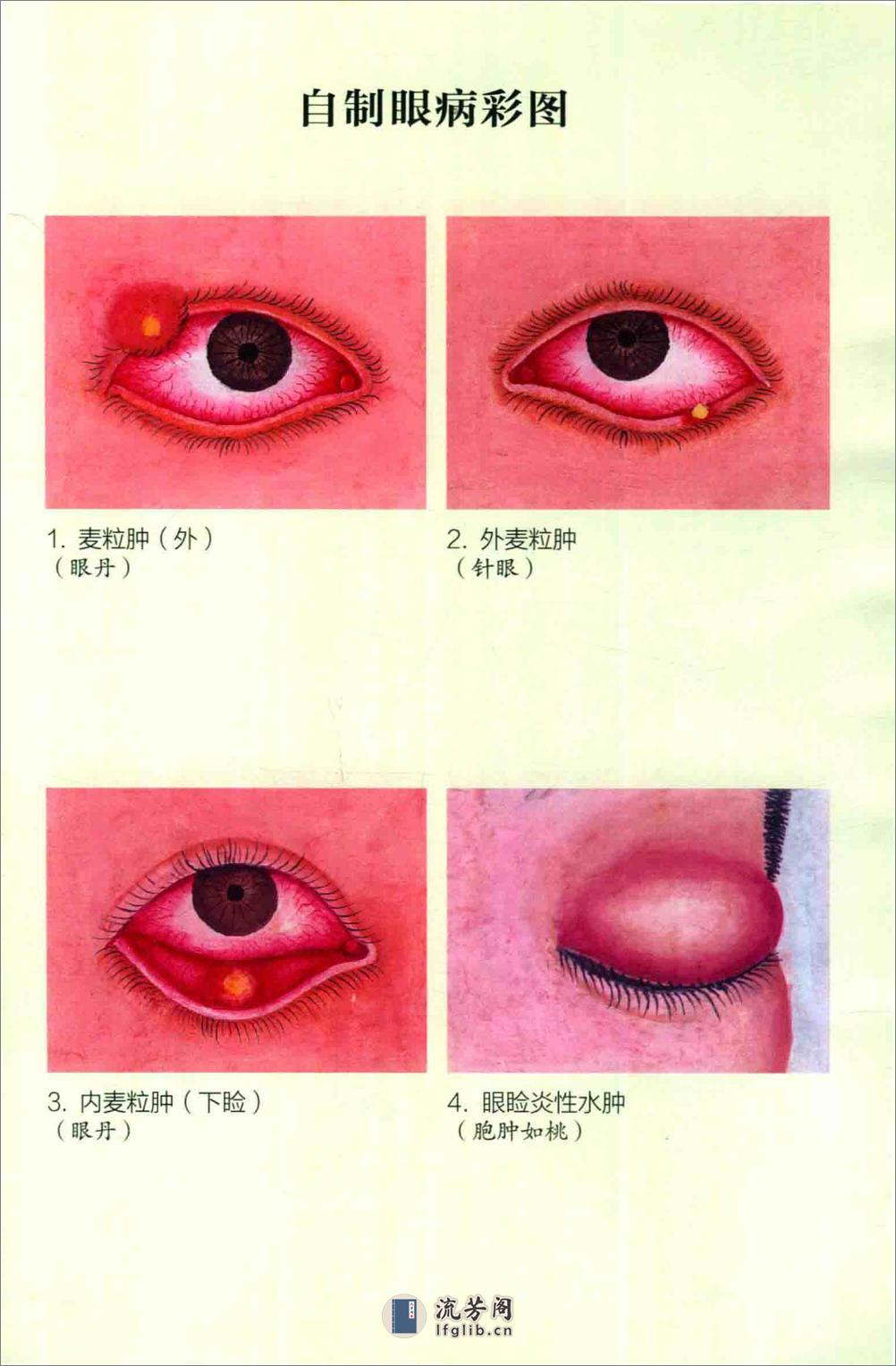 眼病治疗绝招 王霖有 _978-7-5132-4379-7 - 第5页预览图