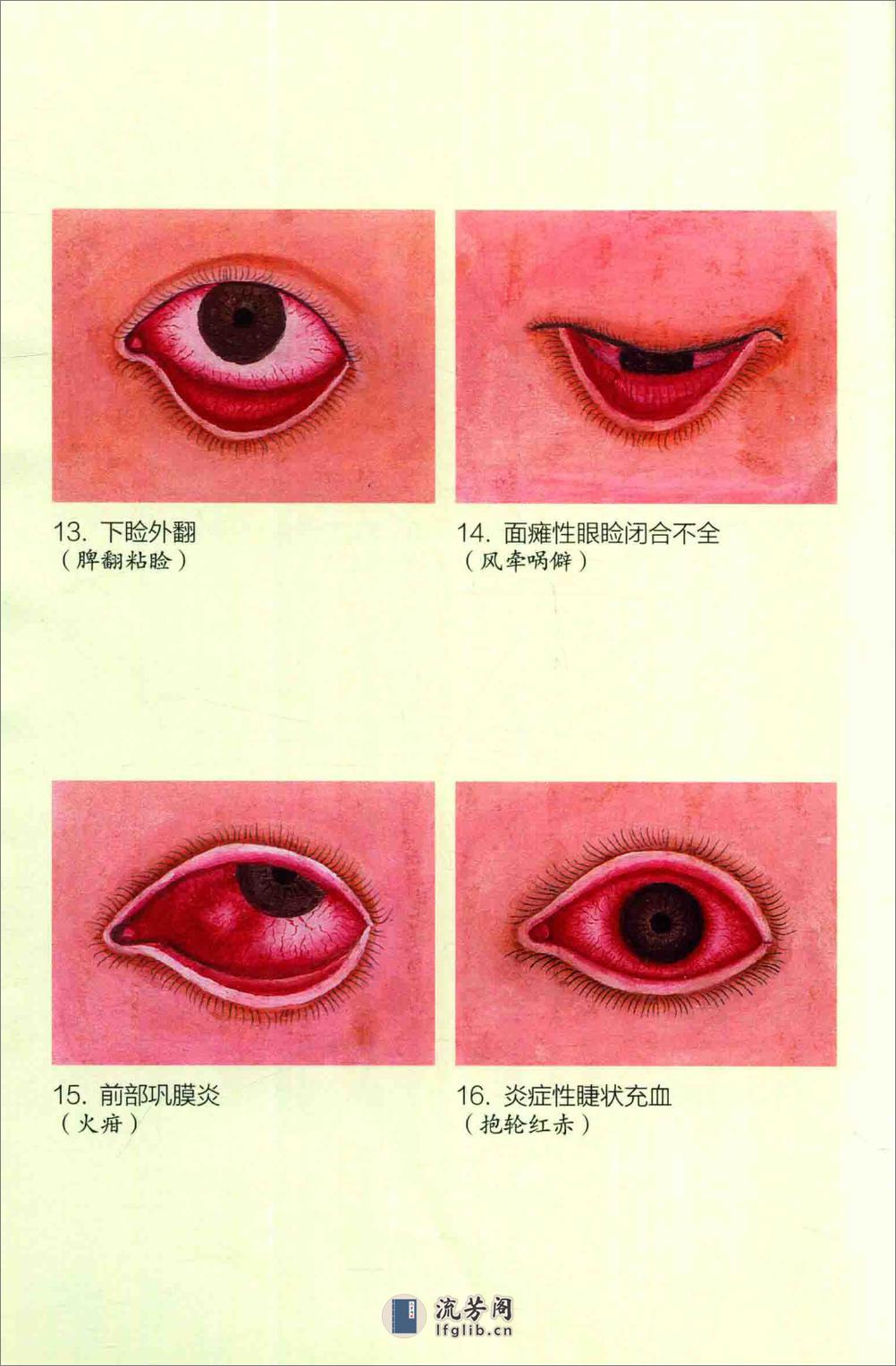 眼病治疗绝招 王霖有 _978-7-5132-4379-7 - 第8页预览图