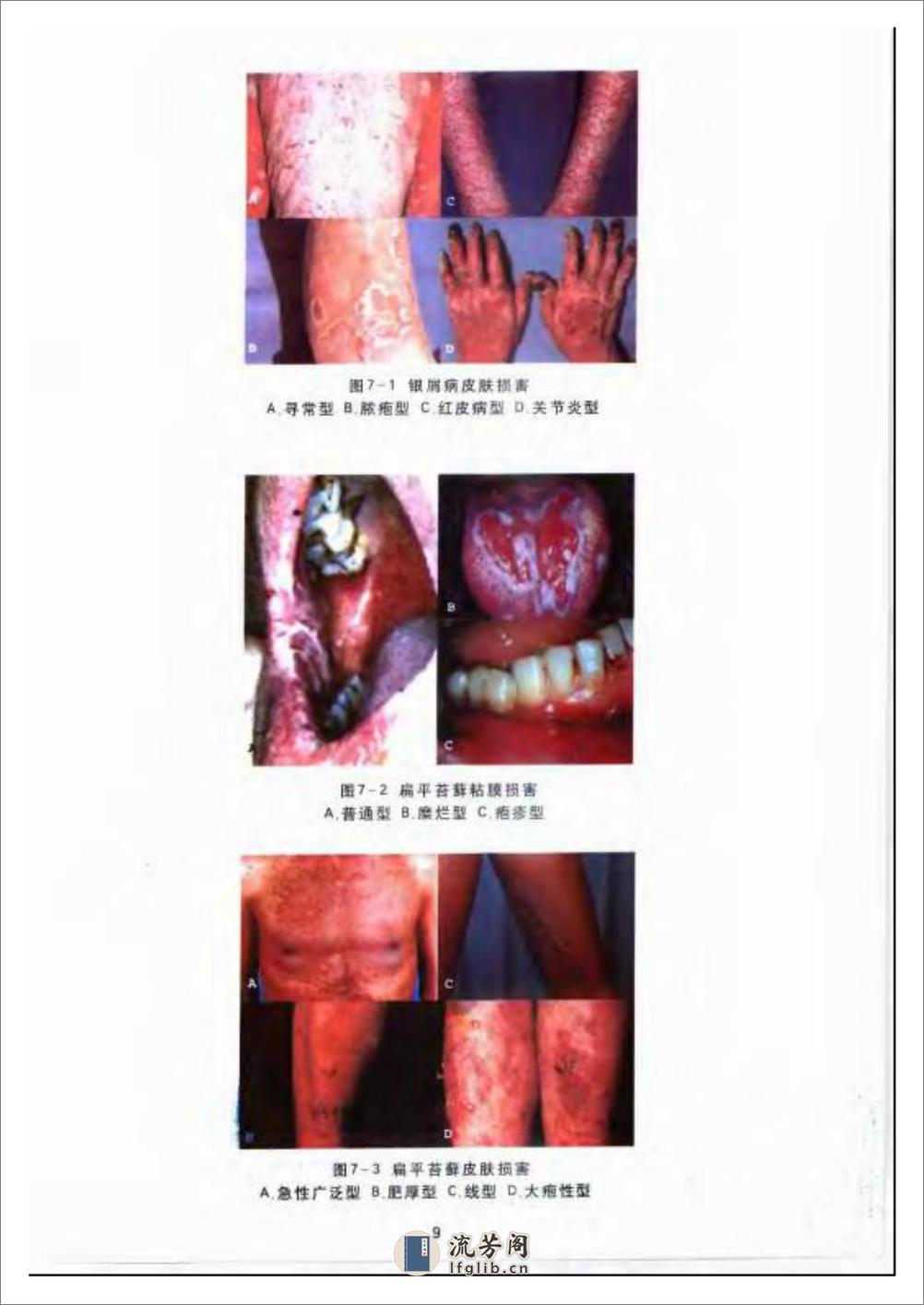口腔黏膜皮肤病学 - 第20页预览图
