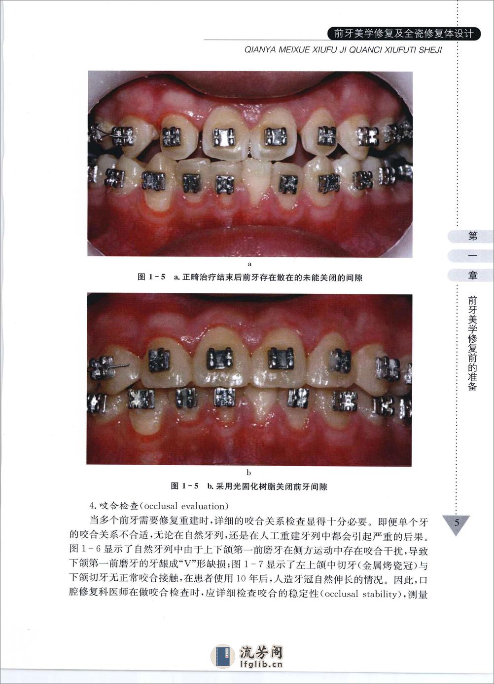 前牙美学修复及全瓷修复体设计 - 第13页预览图