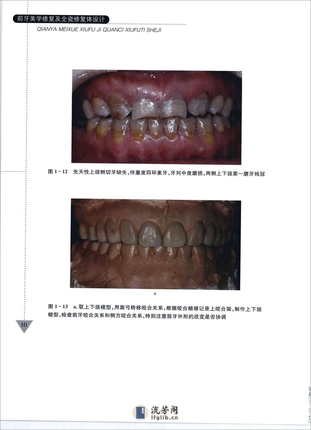 前牙美学修复及全瓷修复体设计 - 第18页预览图