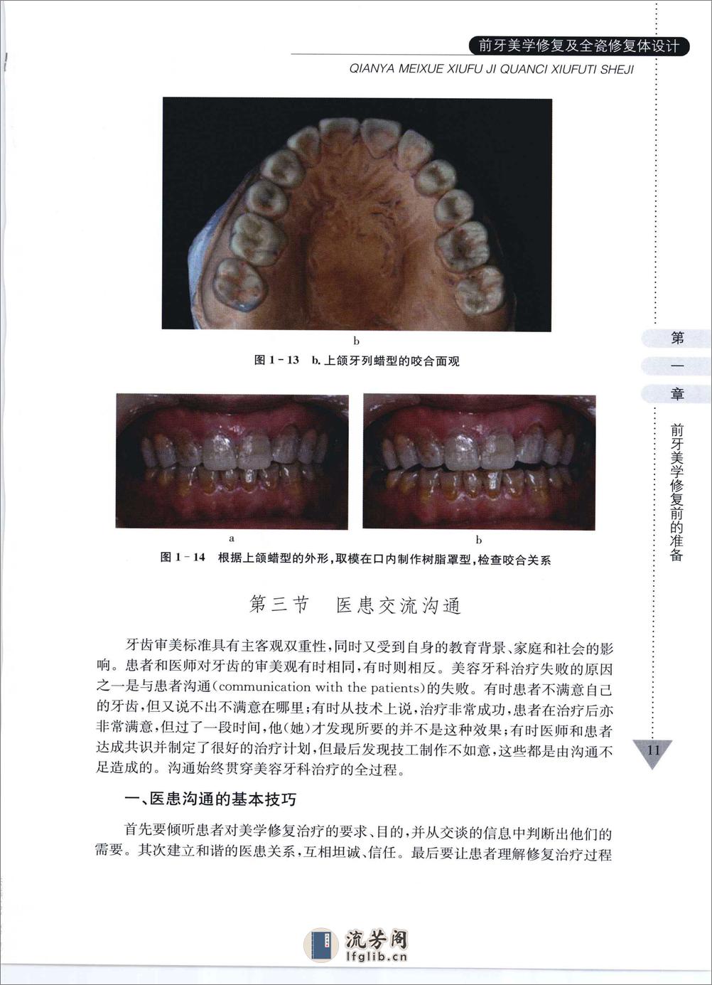 前牙美学修复及全瓷修复体设计 - 第19页预览图