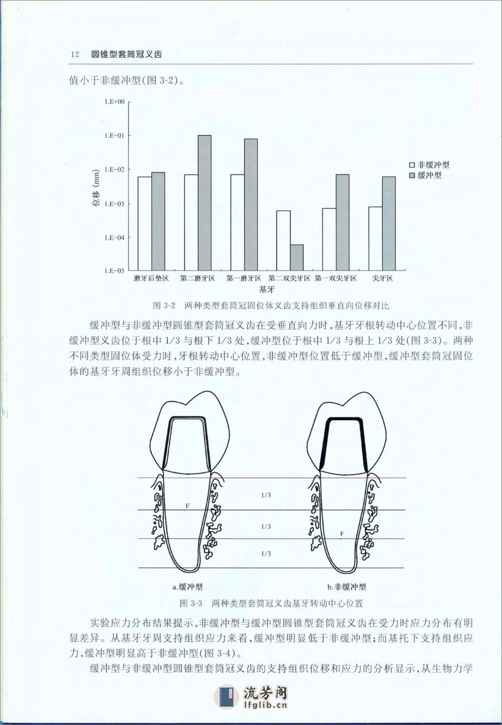 套筒冠 - 第14页预览图