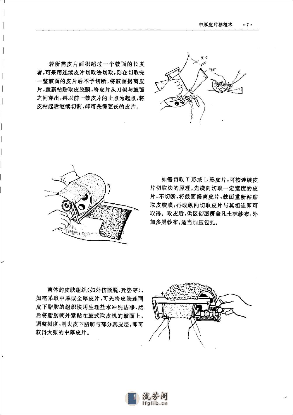 实用手术图解 - 第17页预览图