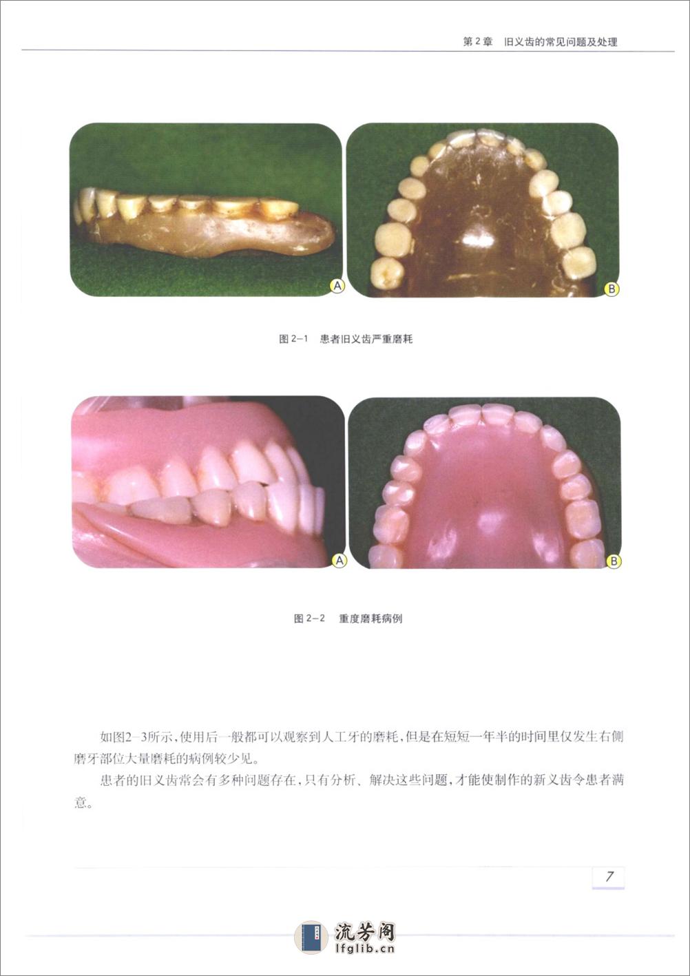 复制义齿+(pnw彩)_12103120 - 第20页预览图