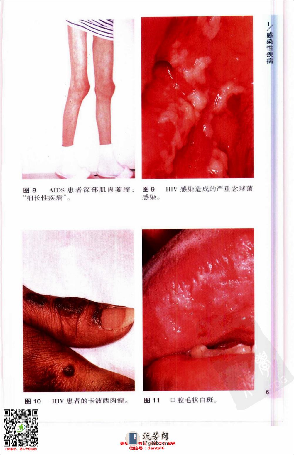 口腔疾病与内、外科学_10422795 - 第12页预览图