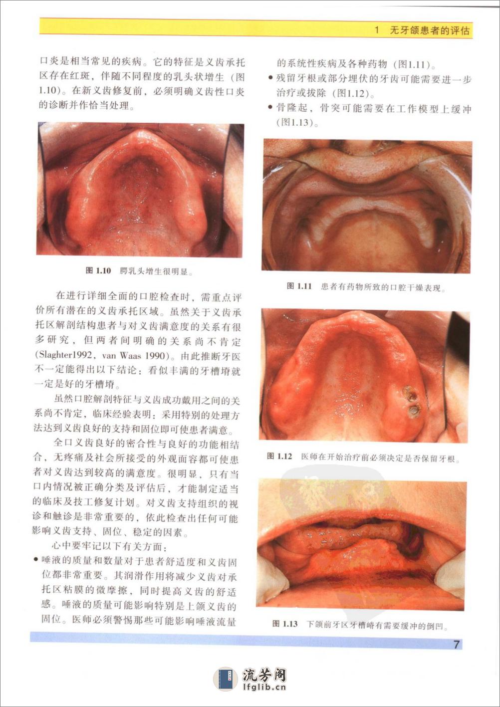 无牙颌患者的治疗 - 第14页预览图