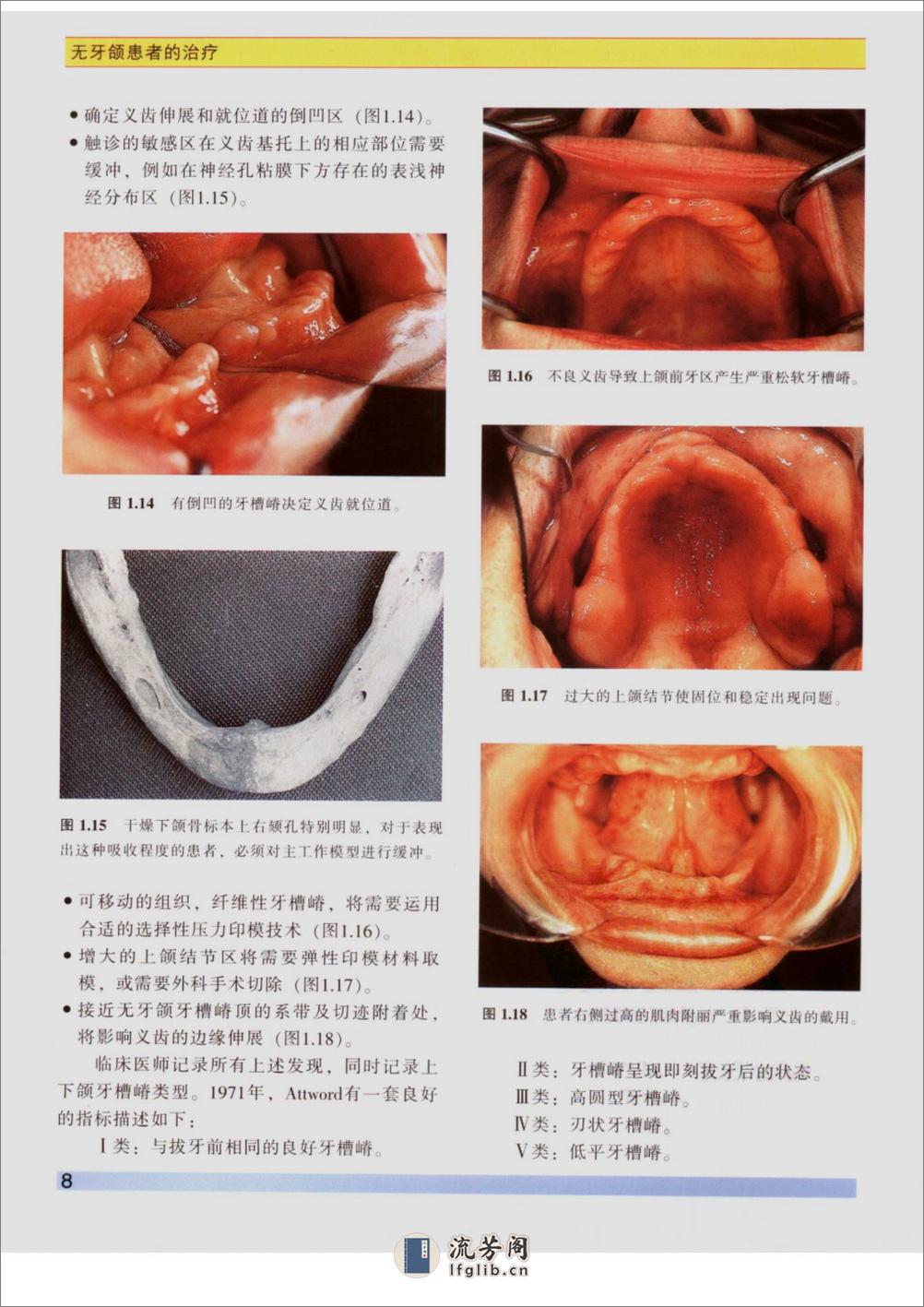 无牙颌患者的治疗 - 第15页预览图