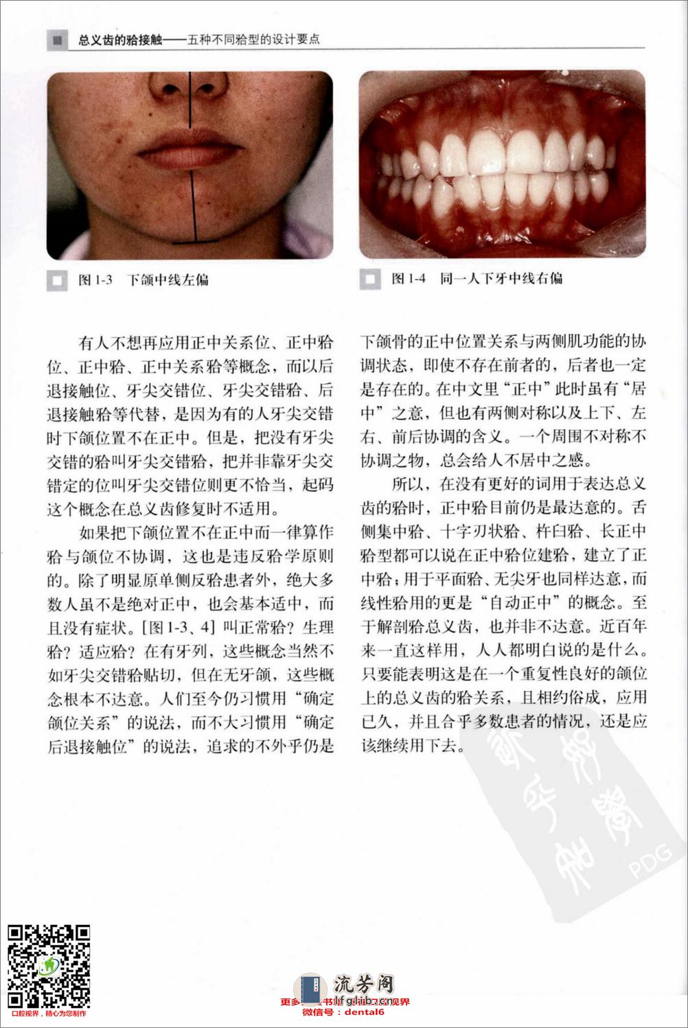 总义齿的合接触：五种不同合型的设计要点 - 第11页预览图