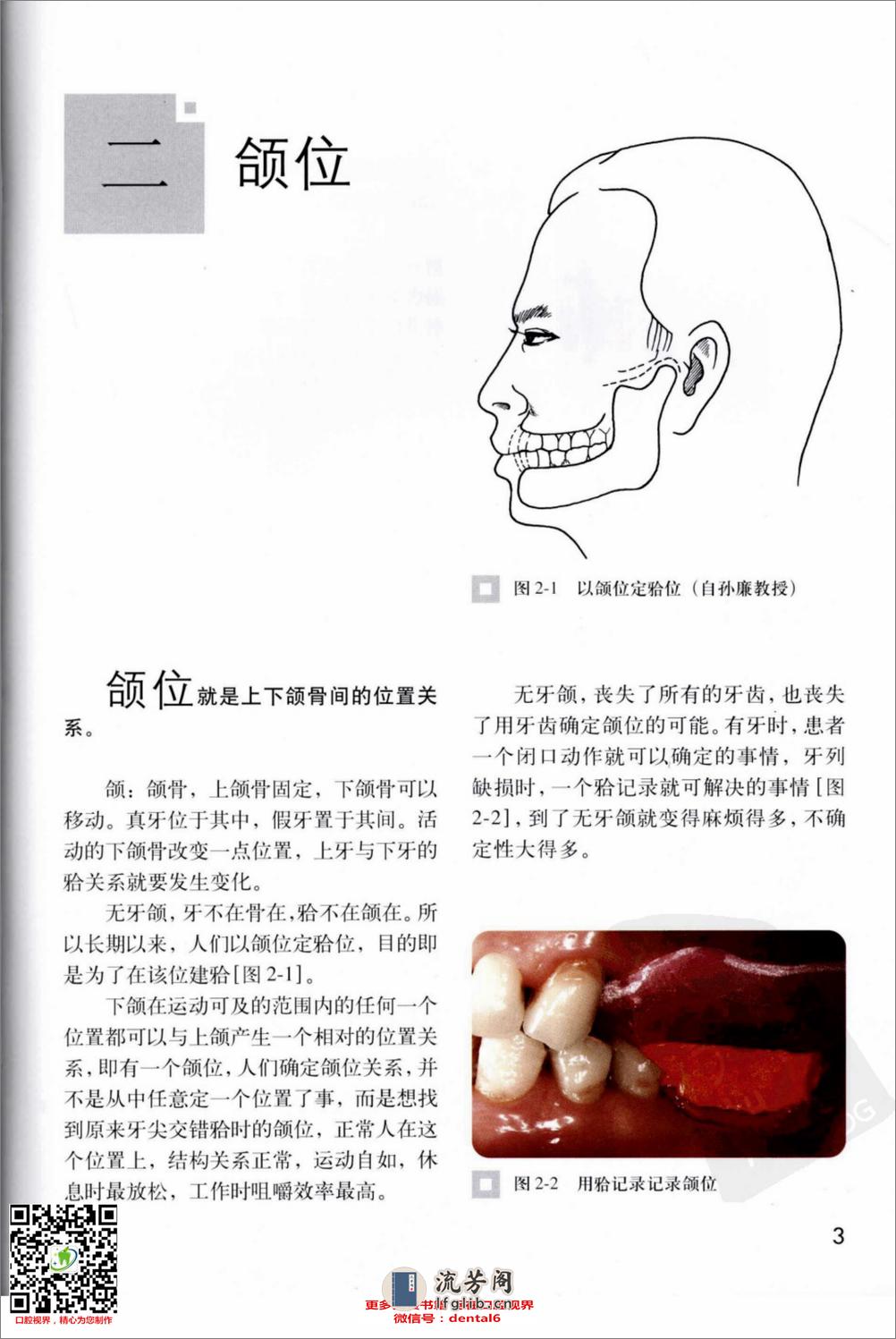 总义齿的合接触：五种不同合型的设计要点 - 第12页预览图