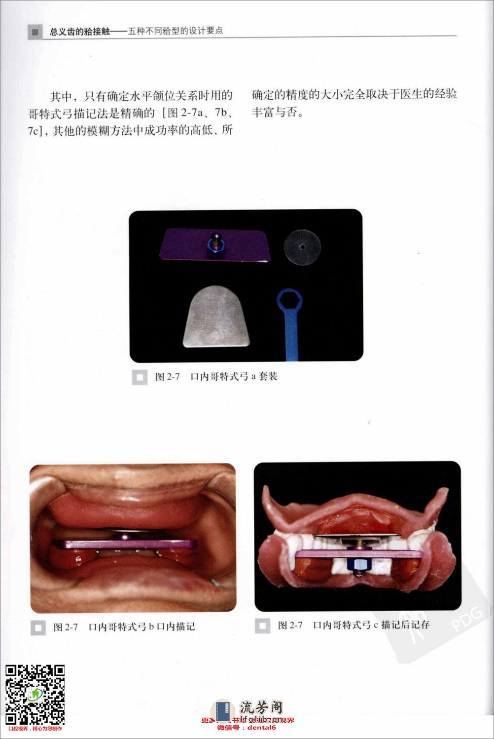 总义齿的合接触：五种不同合型的设计要点 - 第15页预览图