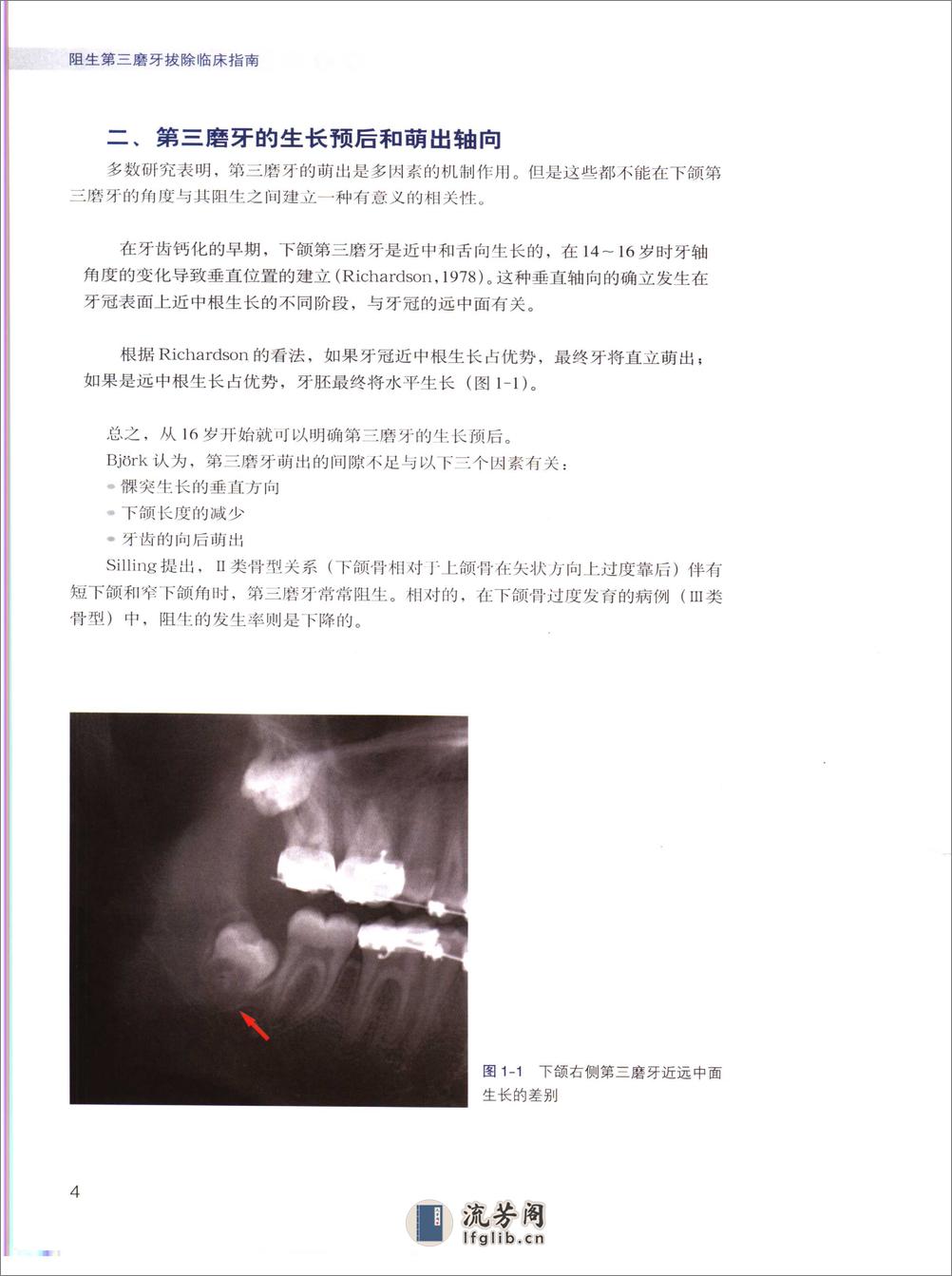 阻生第三磨牙拔除临床指南 - 第12页预览图