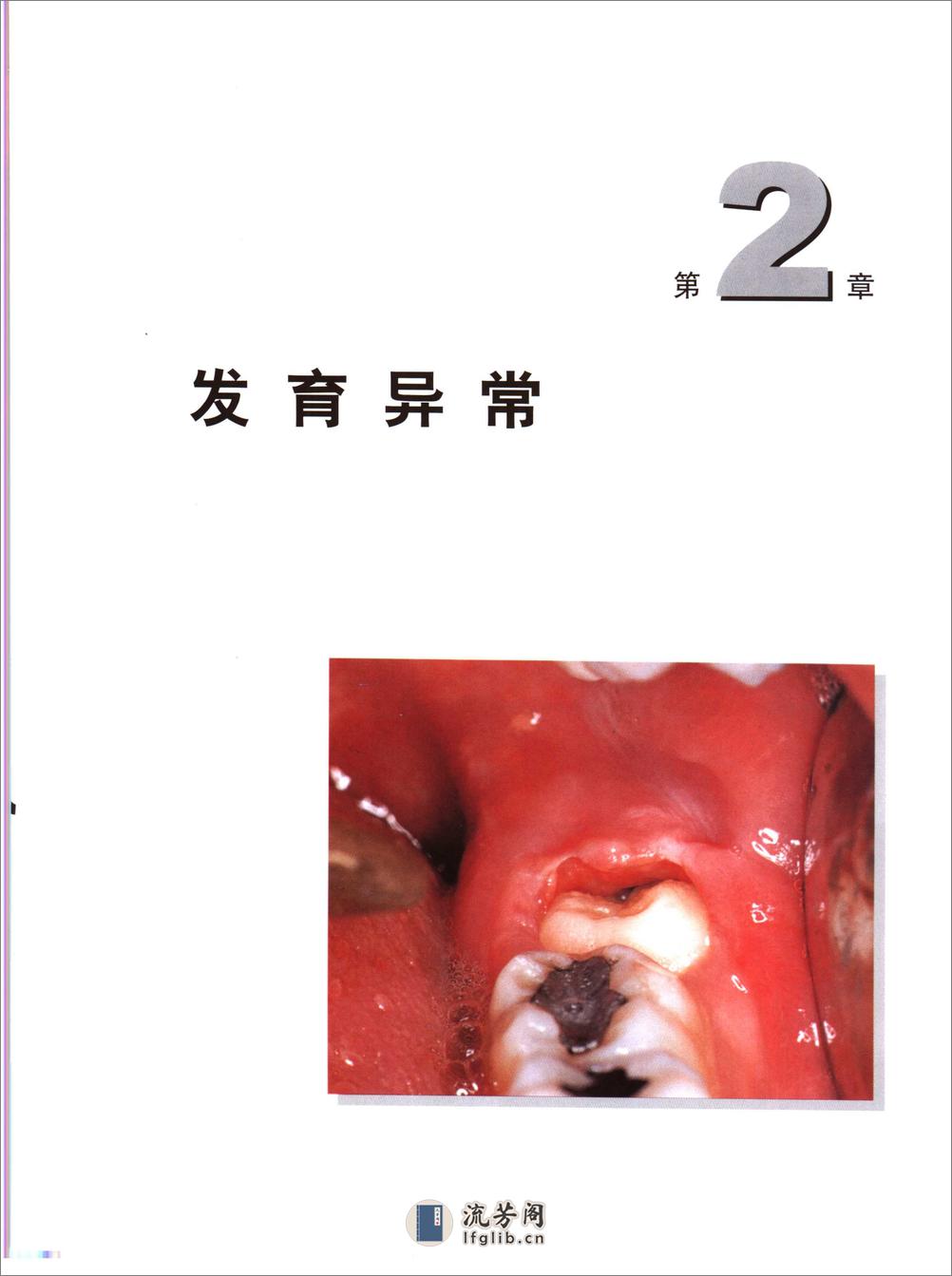 阻生第三磨牙拔除临床指南 - 第17页预览图