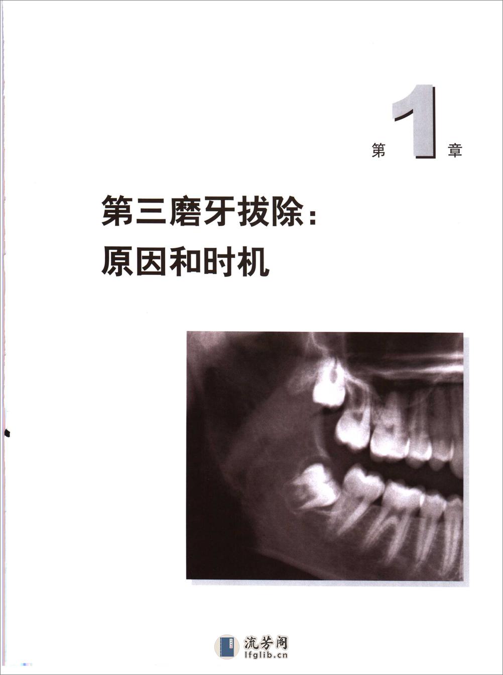 阻生第三磨牙拔除临床指南 - 第9页预览图