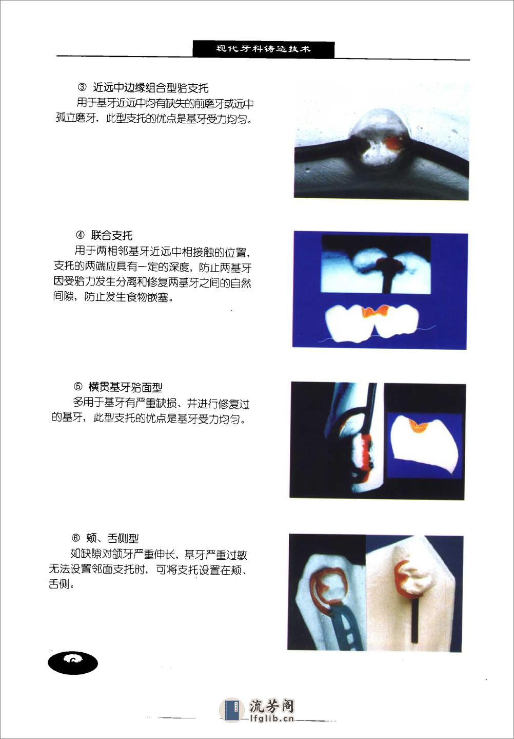 现代牙科铸造技术%2B可摘局部义齿铸造支架制.... - 第13页预览图