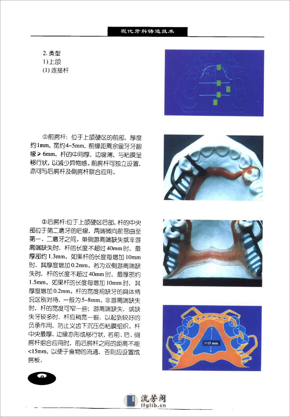 现代牙科铸造技术%2B可摘局部义齿铸造支架制.... - 第15页预览图