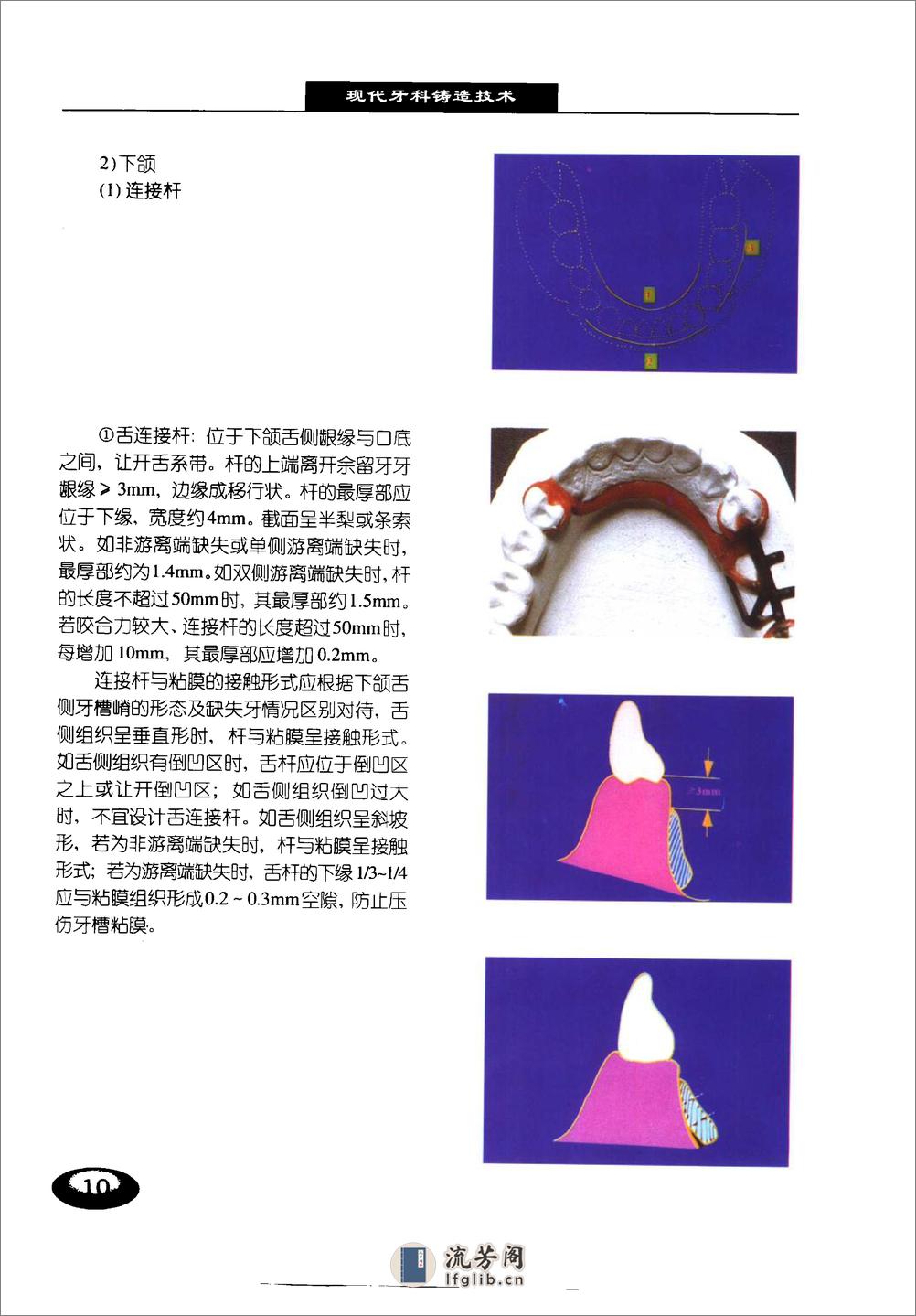 现代牙科铸造技术%2B可摘局部义齿铸造支架制.... - 第17页预览图