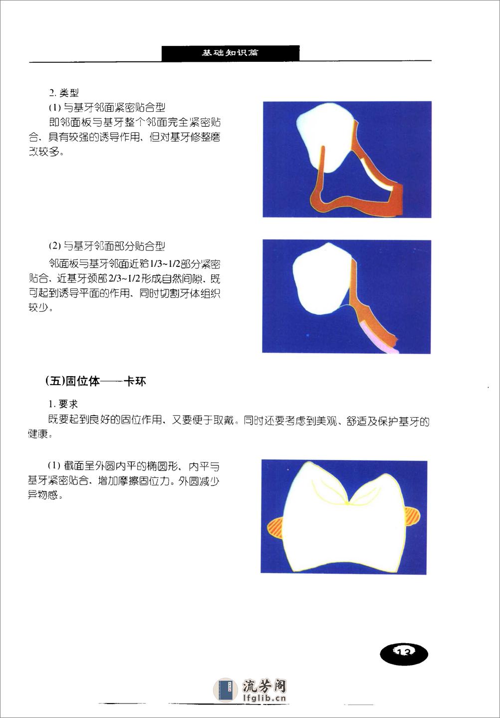 现代牙科铸造技术%2B可摘局部义齿铸造支架制.... - 第20页预览图