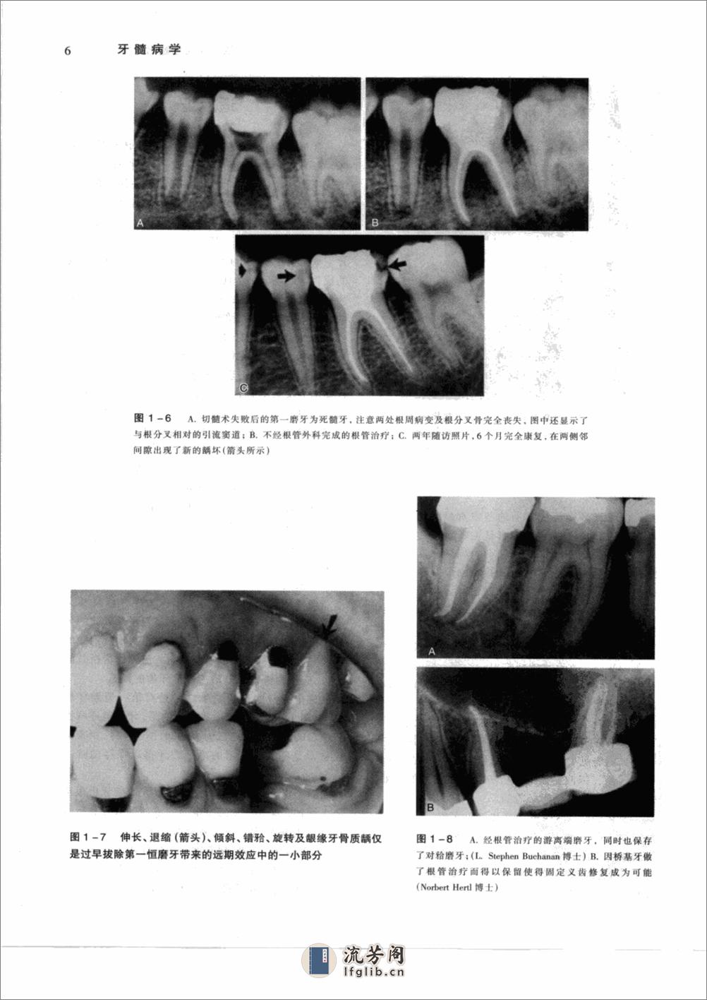 牙髓病学(pnw)清晰版_12347971 - 第12页预览图