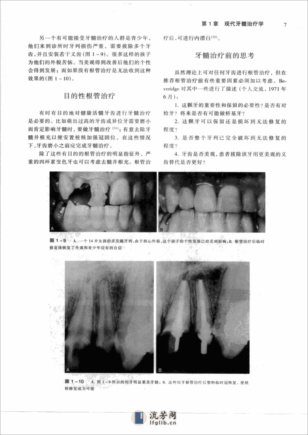 牙髓病学(pnw)清晰版_12347971 - 第13页预览图