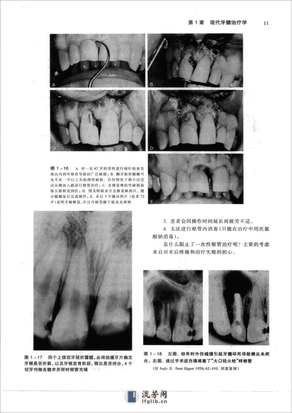 牙髓病学(pnw)清晰版_12347971 - 第17页预览图