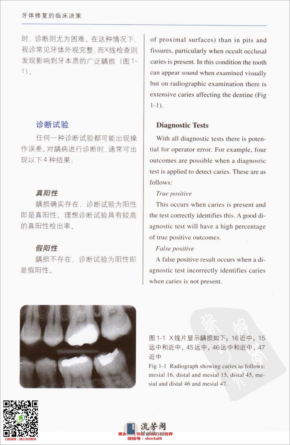 牙体修复的临床决策口腔临床要点快速掌握系列11 - 第11页预览图