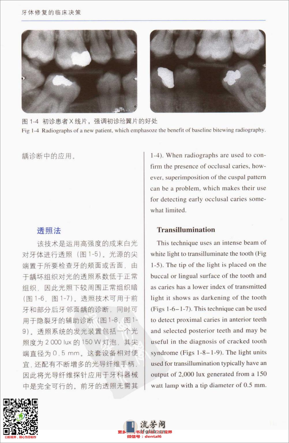 牙体修复的临床决策口腔临床要点快速掌握系列11 - 第15页预览图