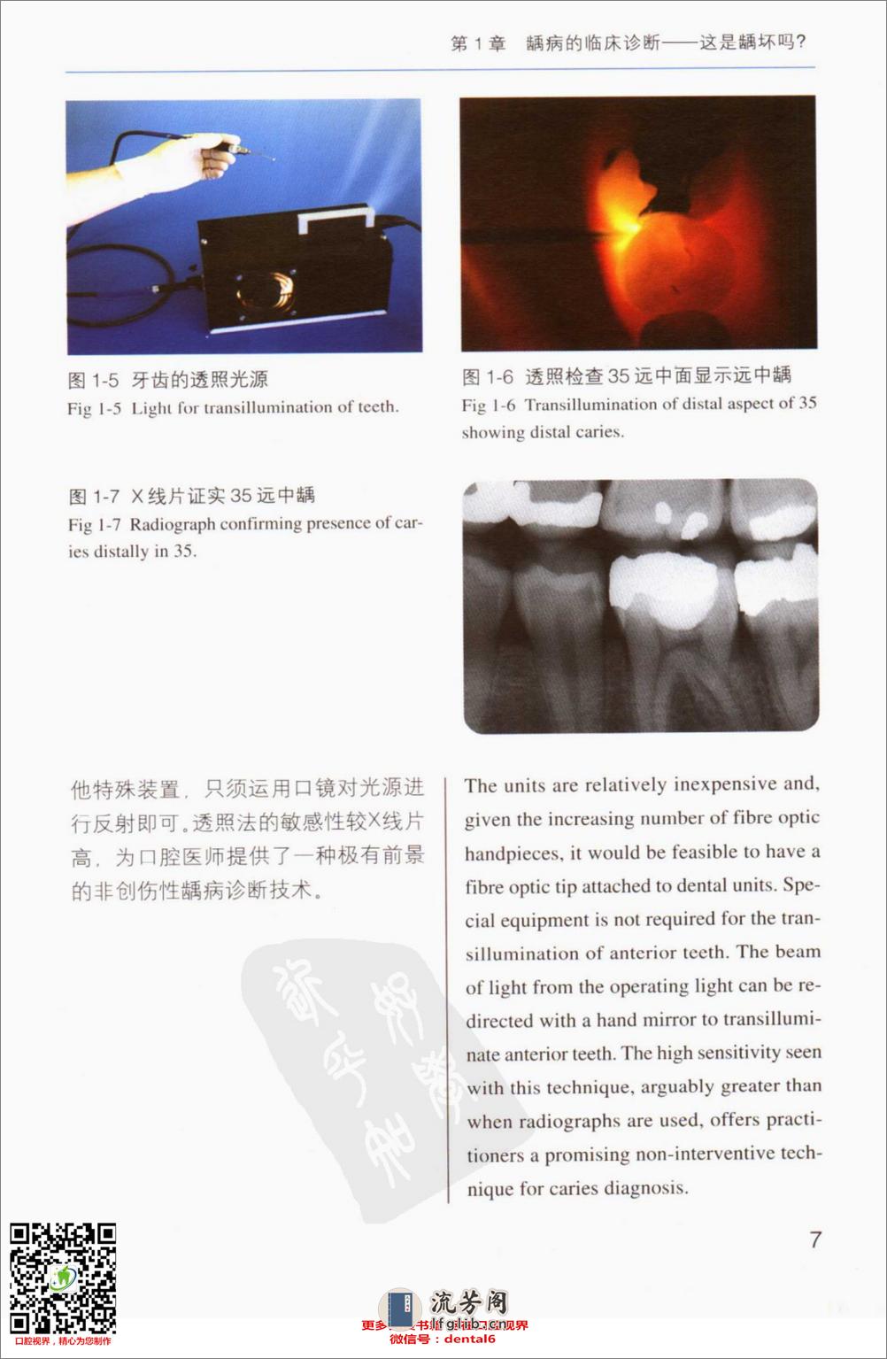 牙体修复的临床决策口腔临床要点快速掌握系列11 - 第16页预览图