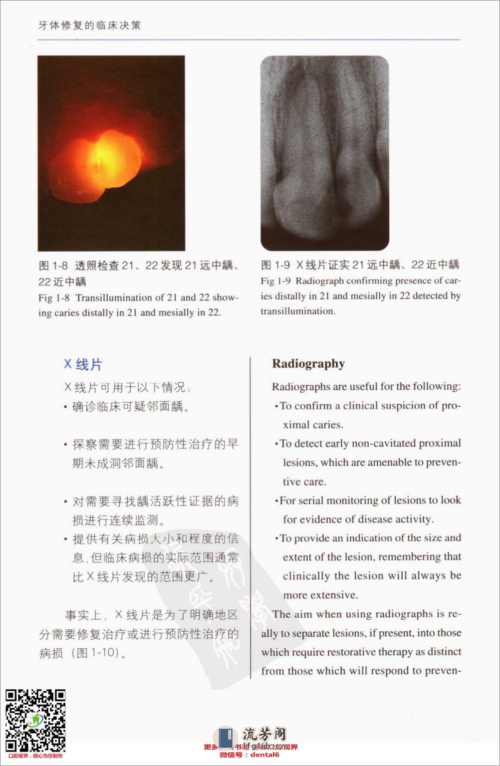 牙体修复的临床决策口腔临床要点快速掌握系列11 - 第17页预览图