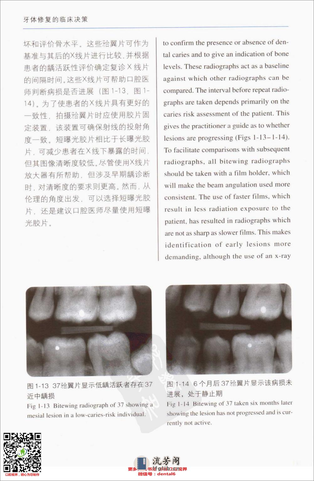 牙体修复的临床决策口腔临床要点快速掌握系列11 - 第19页预览图