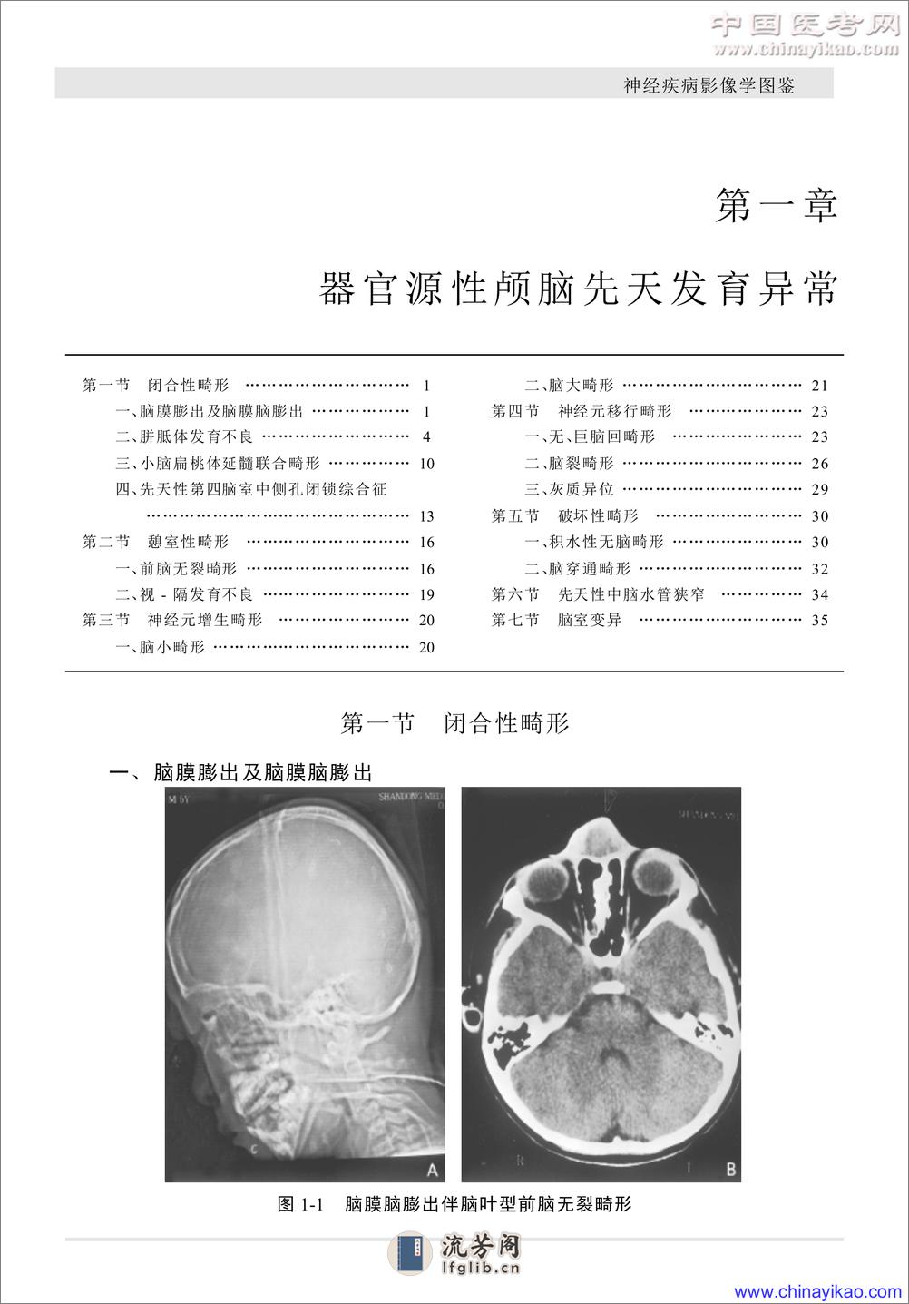 W-神经疾病影像学图鉴——武乐斌 柳 澄 王光彬-2002 - 第11页预览图