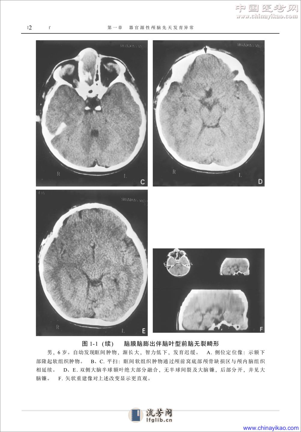 W-神经疾病影像学图鉴——武乐斌 柳 澄 王光彬-2002 - 第12页预览图