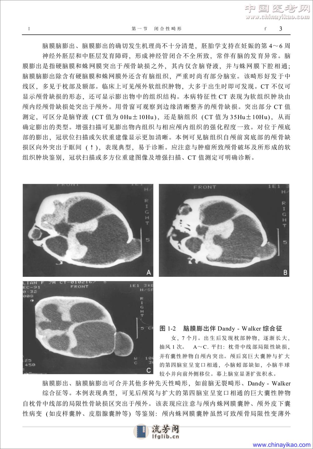 W-神经疾病影像学图鉴——武乐斌 柳 澄 王光彬-2002 - 第13页预览图