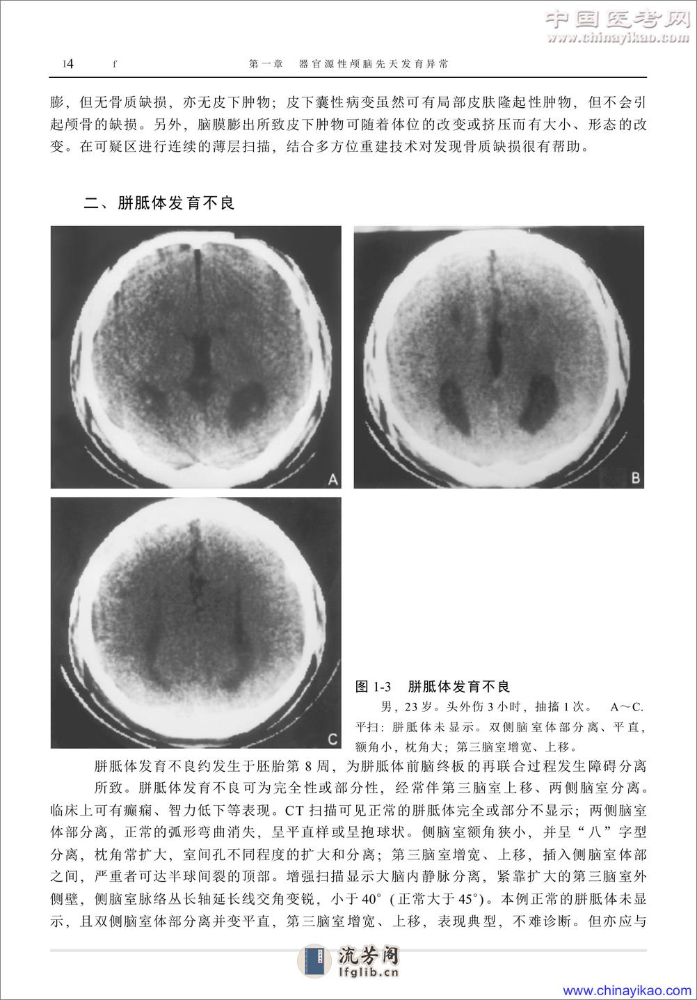 W-神经疾病影像学图鉴——武乐斌 柳 澄 王光彬-2002 - 第14页预览图