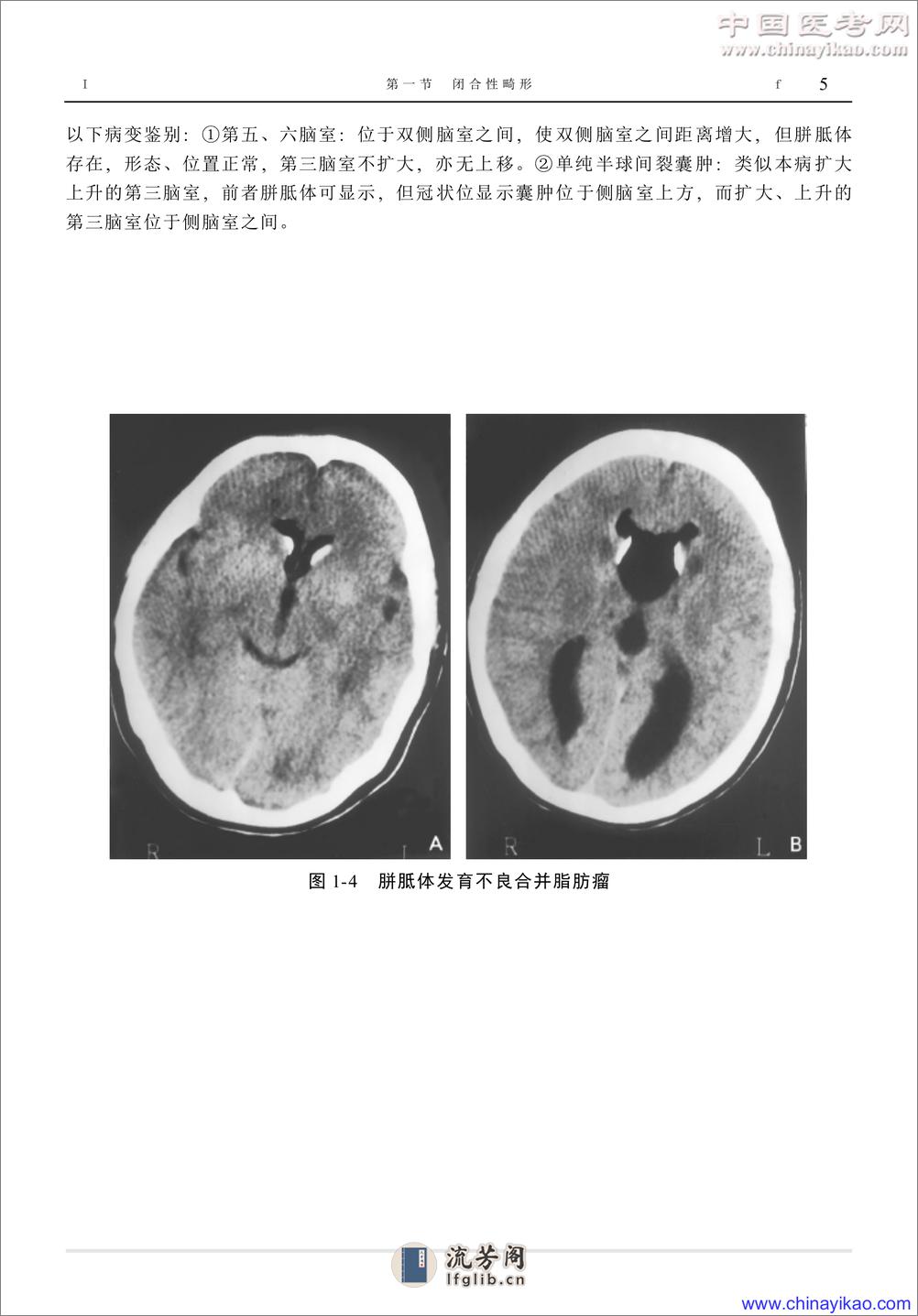 W-神经疾病影像学图鉴——武乐斌 柳 澄 王光彬-2002 - 第15页预览图