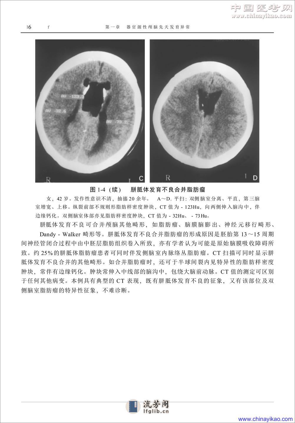 W-神经疾病影像学图鉴——武乐斌 柳 澄 王光彬-2002 - 第16页预览图