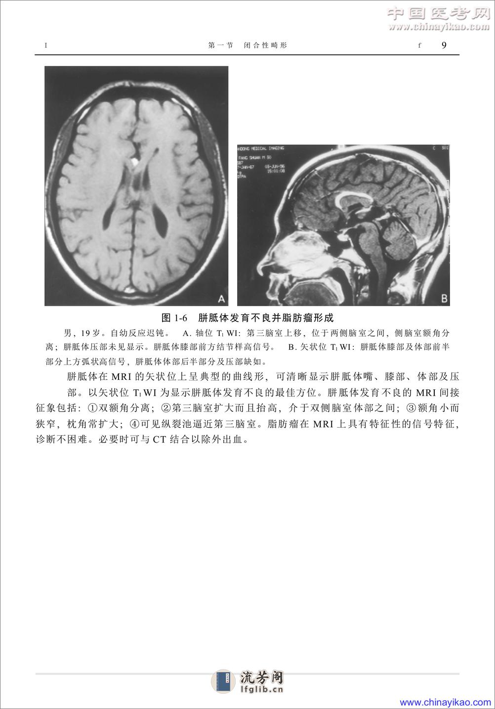 W-神经疾病影像学图鉴——武乐斌 柳 澄 王光彬-2002 - 第19页预览图