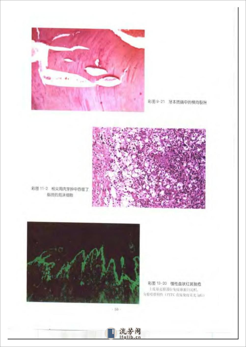 口腔组织病理学（第五版）（高教材）（于世... - 第18页预览图