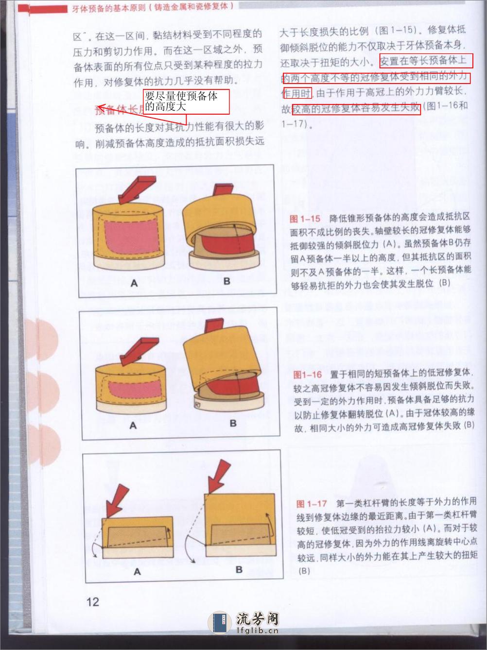 牙体预备原则 - 第14页预览图