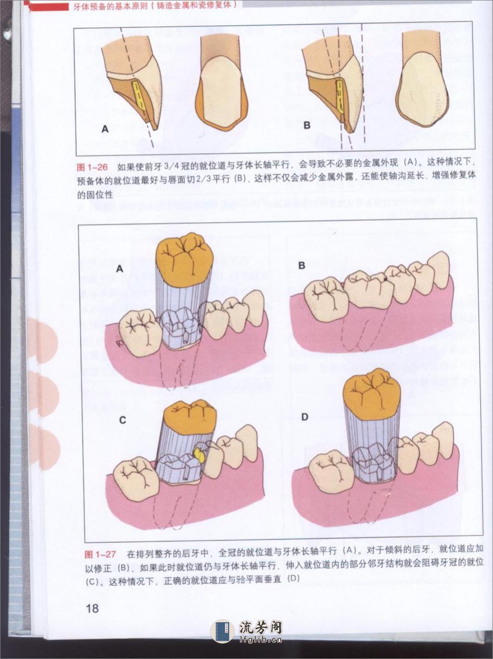 牙体预备原则 - 第20页预览图