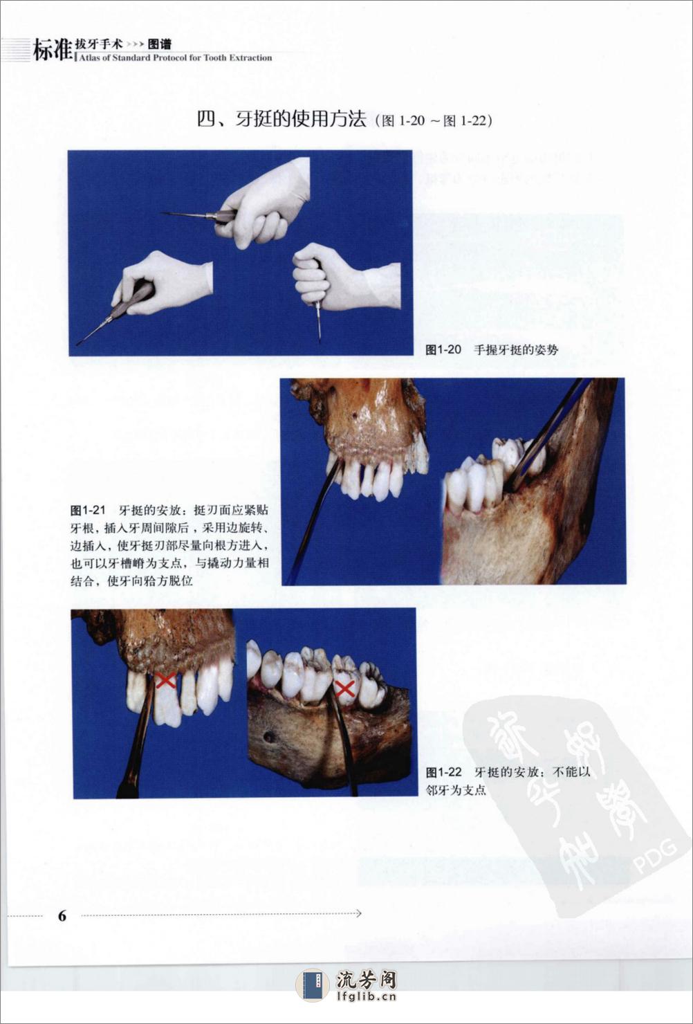 标准拔牙手术图谱 - 第20页预览图