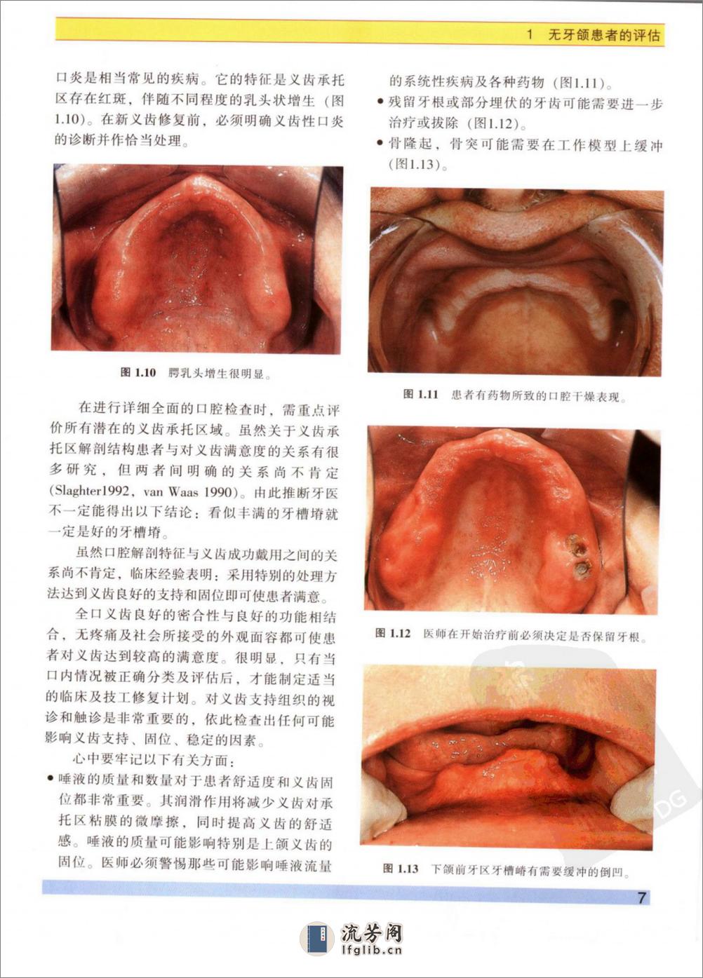 无牙颌患者的治疗 - 第14页预览图