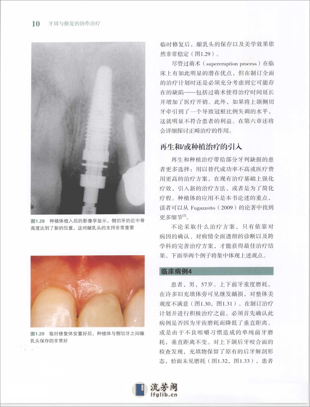 牙周与修复的协作治疗 - 第18页预览图