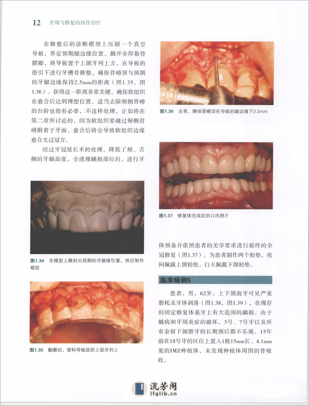 牙周与修复的协作治疗 - 第20页预览图