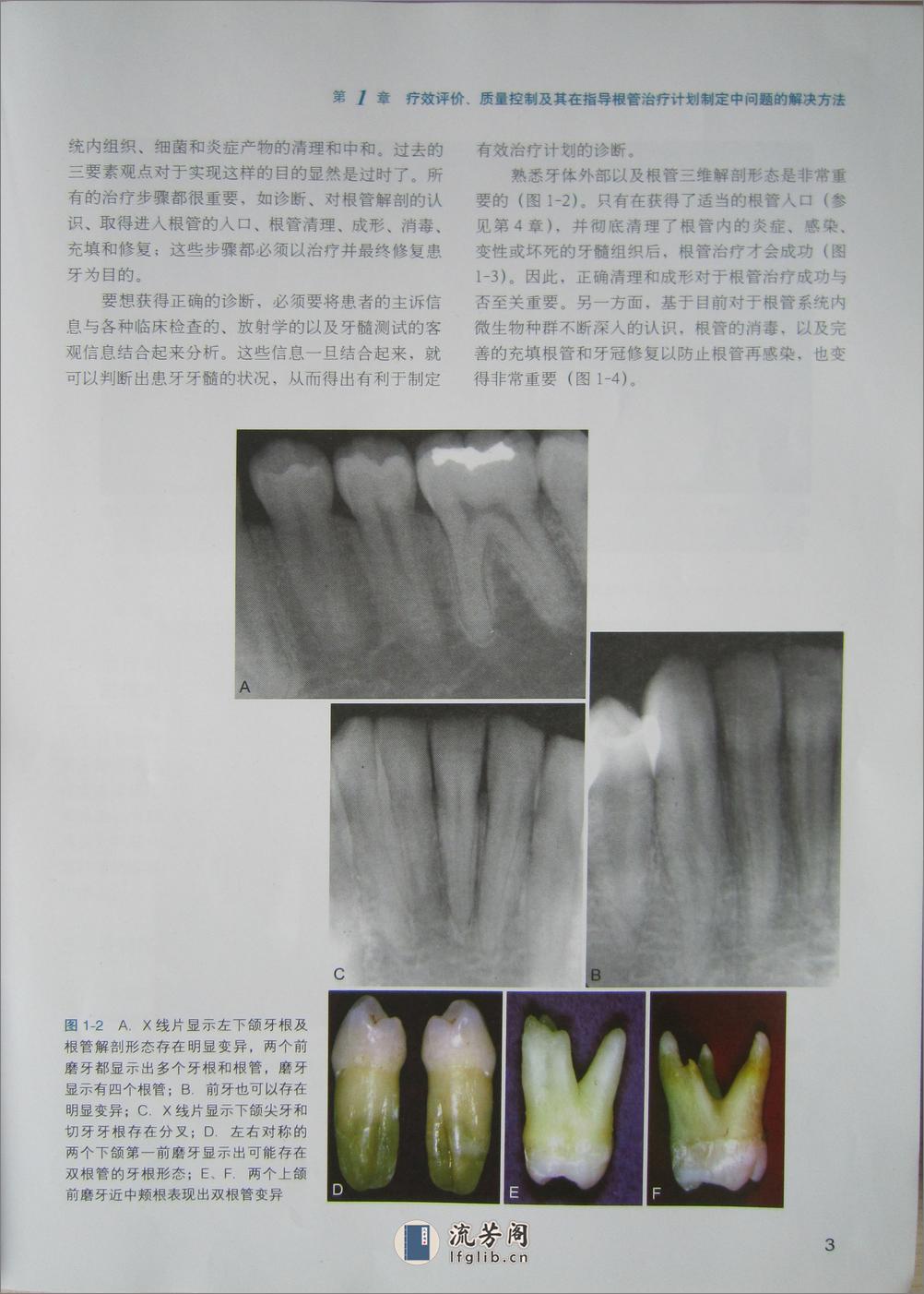 牙髓病临床病例释疑 - 第13页预览图