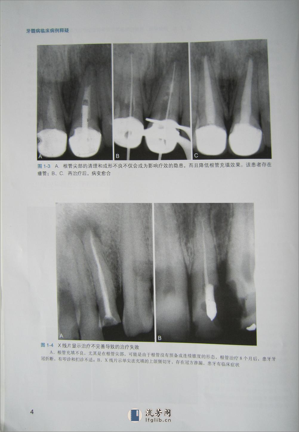 牙髓病临床病例释疑 - 第14页预览图