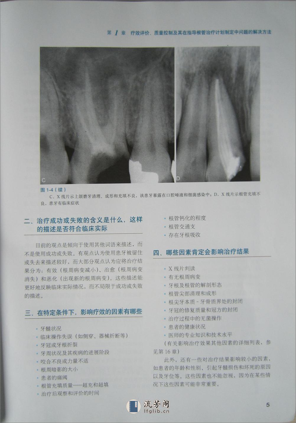 牙髓病临床病例释疑 - 第15页预览图