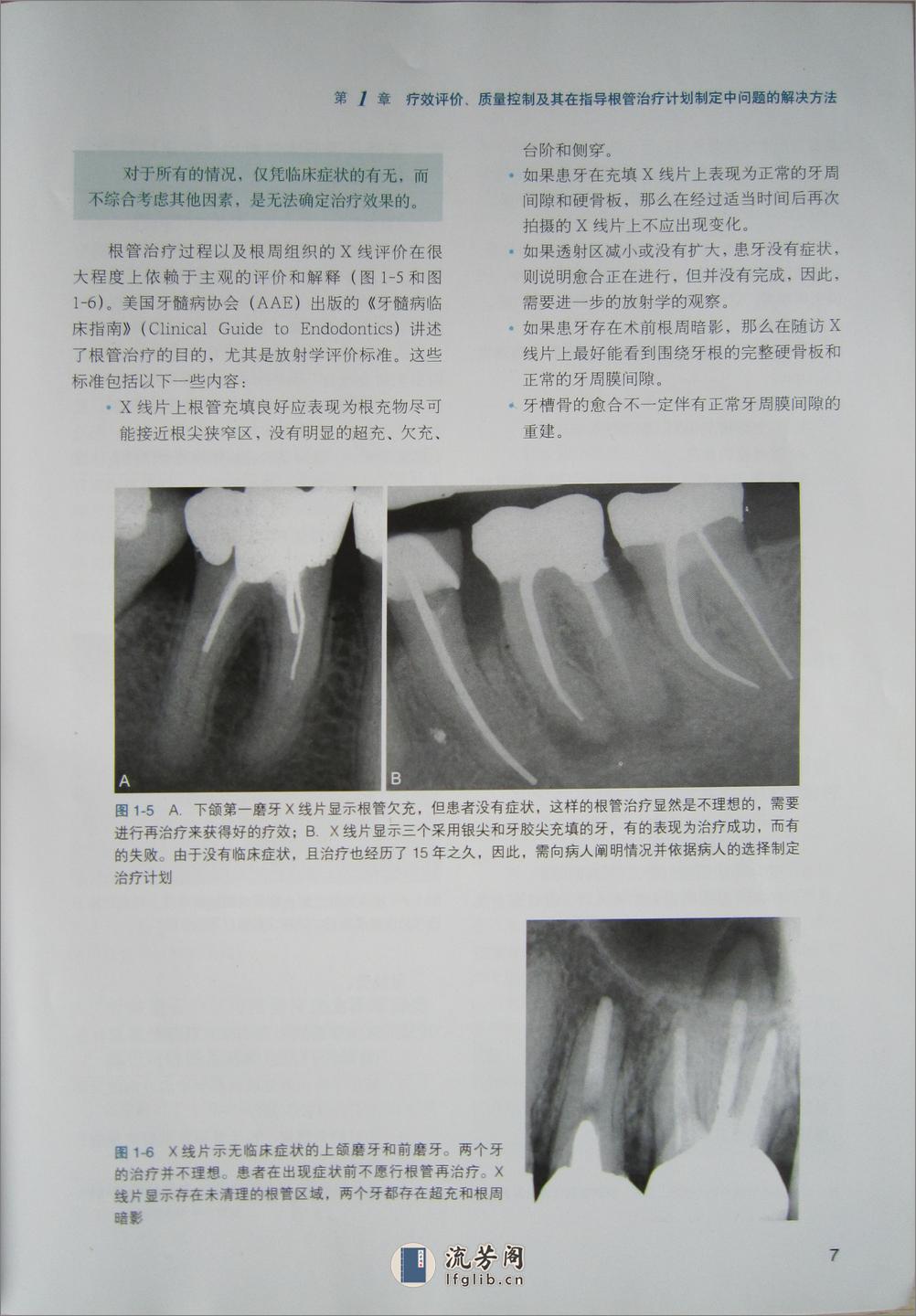 牙髓病临床病例释疑 - 第17页预览图